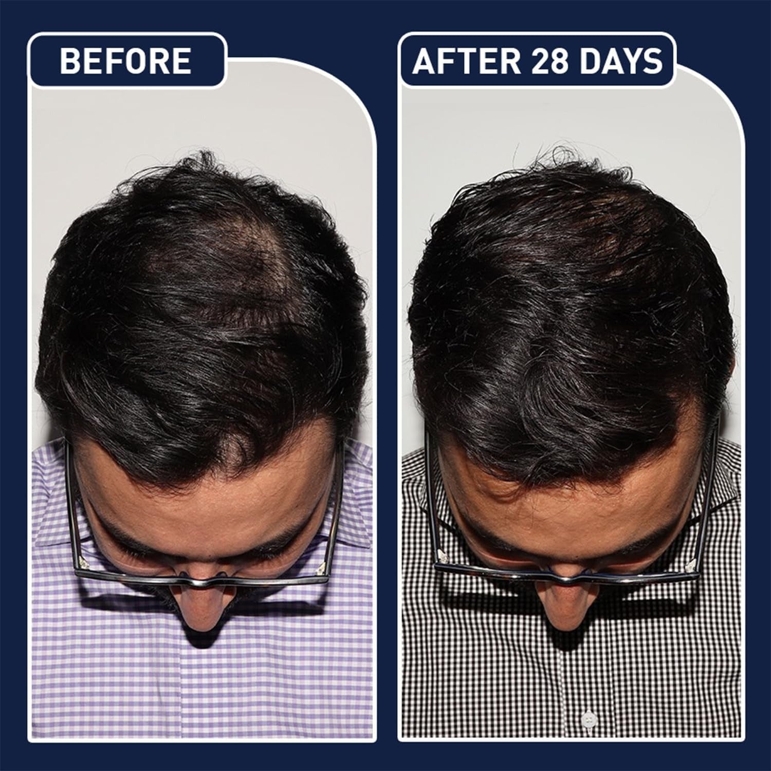 FEG Plus Hair Growth Stimulator Spray – Natural Formula with Anagain, Rosemary & Camellia (50ml)