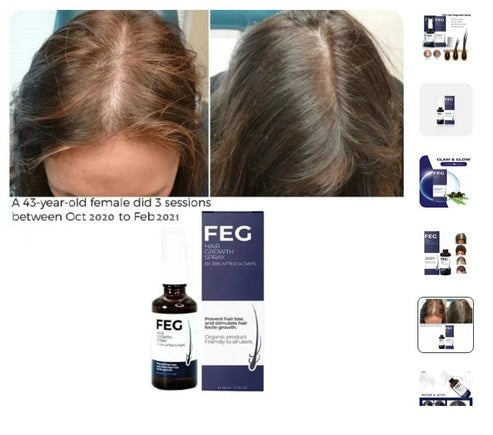FEG Hair Growth Spray for Thicker, Fuller Hair – Organic Hair Loss Solution for Men & Women (50ml)